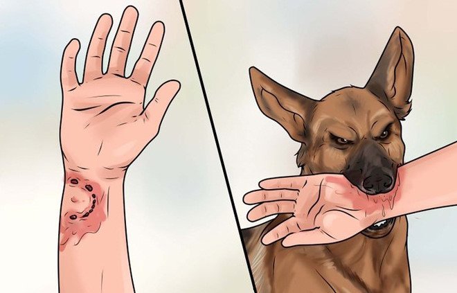 Bệnh Chó cắn: Nguyên nhân, biến chứng và cách điều trị